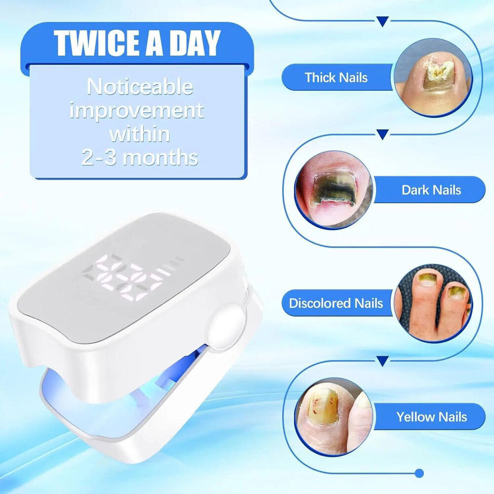 Nail Fungus Laser Treatment Device for Multiple Toenail Onychomycosis Remover US