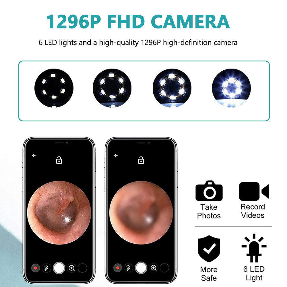 Wi-Fi Visible Ear Wax Elimination Spoon USB 1080P HD Load Otoscope Endoscope US