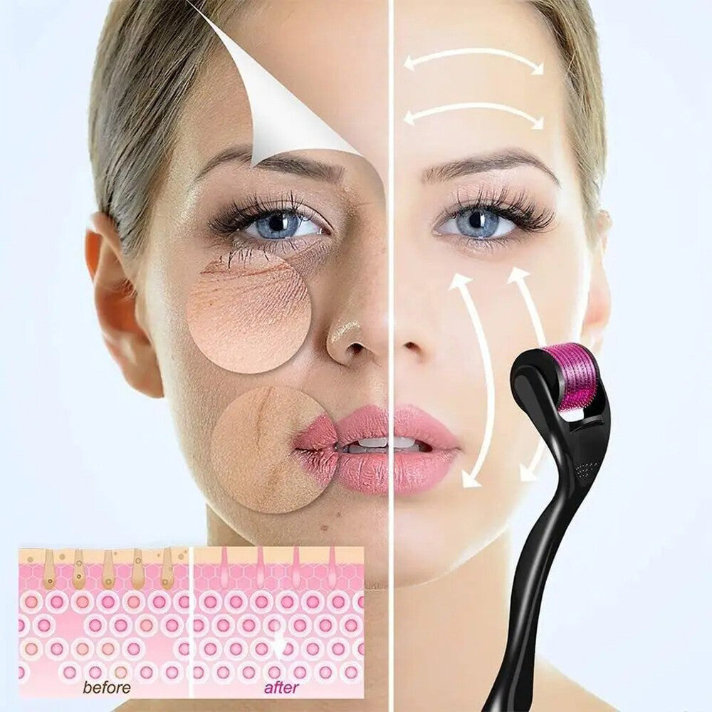 3 Pairs Derma Roller - 0.25Mm & 0.50Mm & 1.50Mm / 540 Scar Titanium Microneedle