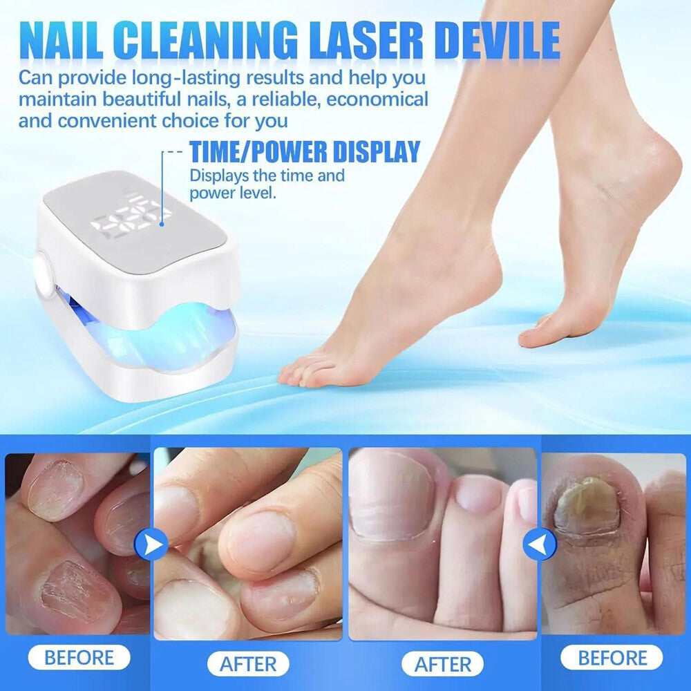 Nail Fungus Laser Treatment Device for Multiple Toenail Onychomycosis Remover US
